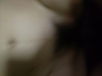 大陰唇2